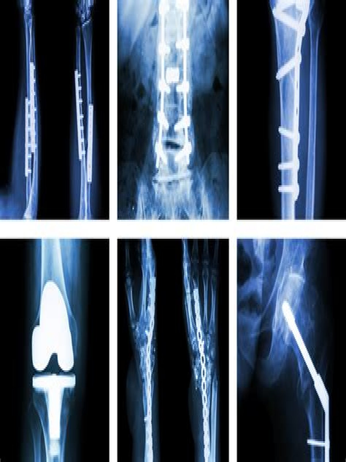 Do Orthopedic Surgeons Have Their Own Ray Machines?